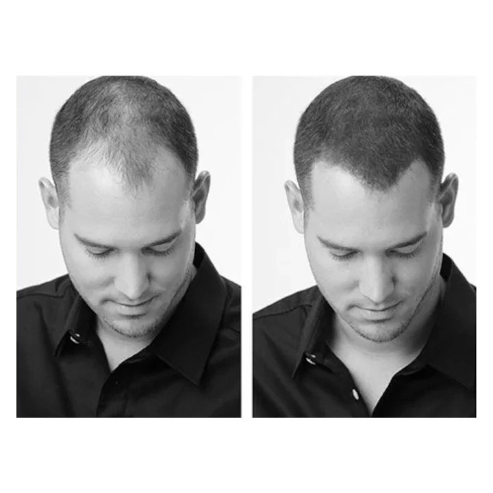 Hair30-Uomo