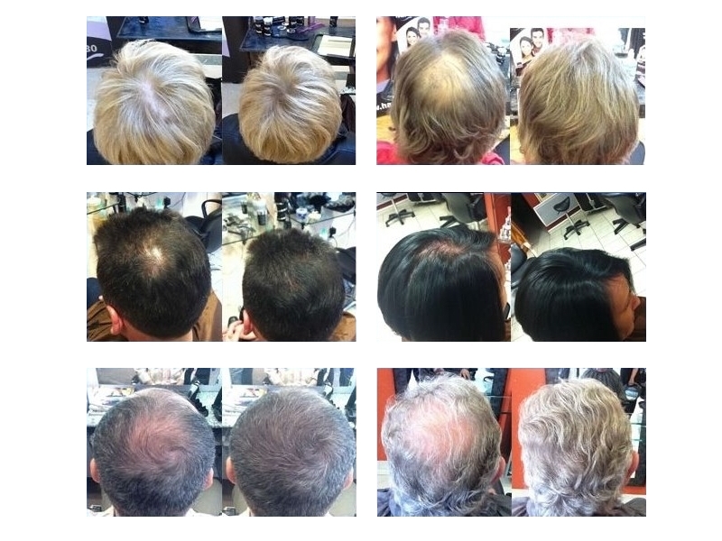 Führen-Sie-vor-und-nach-Hair30